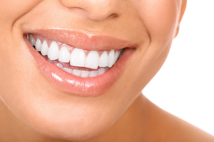 Appareillage à Courbevoie orthodontiste courbevoie levallois Appareillage