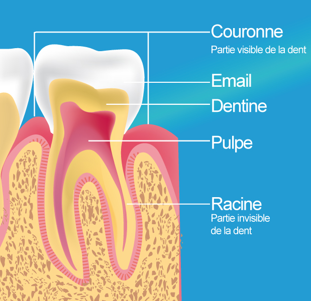 Dévitalisation - Traitement  Endodontique à Paris 16ème